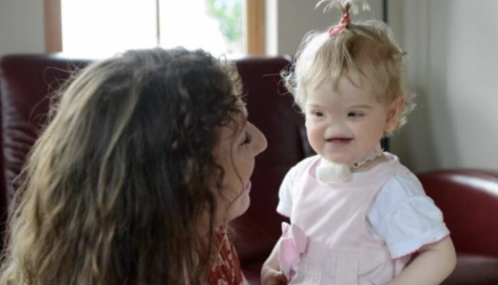 Born extraordinary. See how the girl born without a nose appears today.