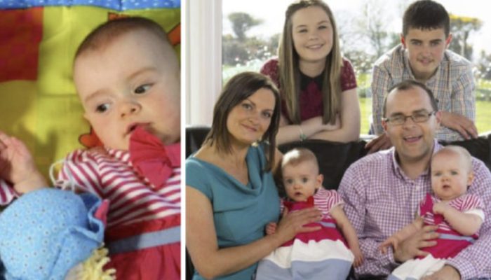 These extraordinary twins are recognized in the Guinness Book of Records. Their story is simply incredible.