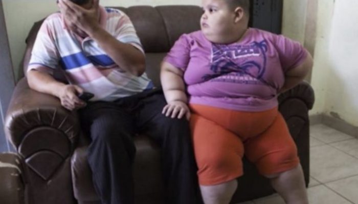 A 5-year-old boy who constantly wants to eat and weighs almost as much as an adult man. See why.