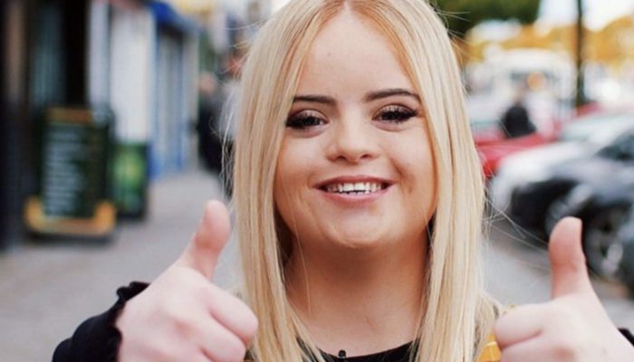 The Down syndrome girl made it clear to the world that she is deserving of being a fashion model.