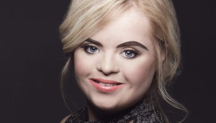 The Down syndrome girl made it clear to the world that she is deserving of being a fashion model.