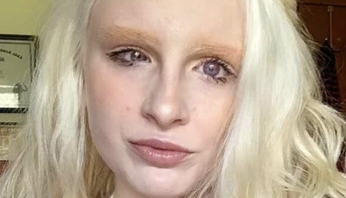 Everyone was surprised when the girl opened her eyes because no one had ever seen her eyes before.