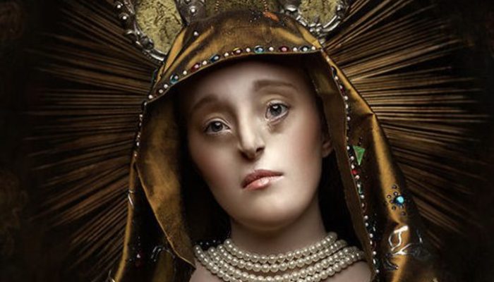 Girl with an unusual facial deformity becomes a successful model, showing that inner beauty is what truly attracts people.