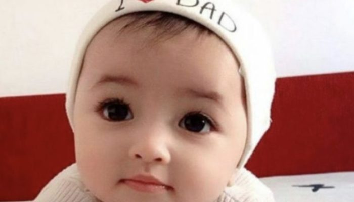 Look at how the girl looks now. She has stunning eyes and a distinct appearance.