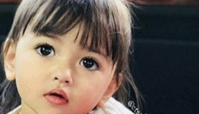 Look at how the girl looks now. She has stunning eyes and a distinct appearance.