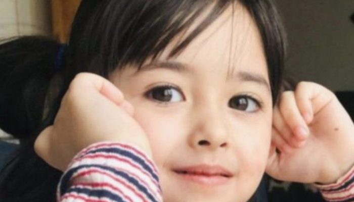 Look at how the girl looks now. She has stunning eyes and a distinct appearance.