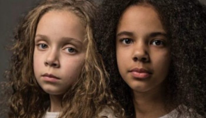At the age of 13, this renowned twins are both remarkably alike and different.
