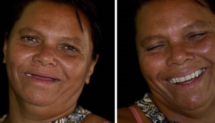 Dentists travel the world for free, restoring people's smiles and faith in God. The results are amazing.