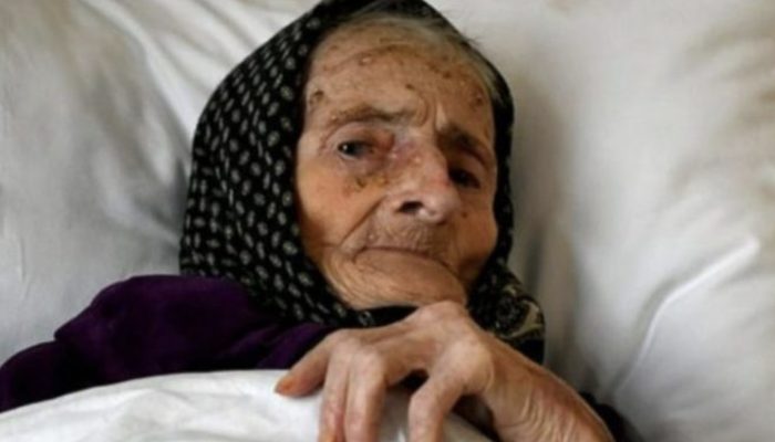 Even doctors could not believe their eyes when they saw the 91-year-old woman.