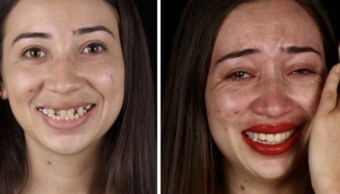 Dentists travel the world for free, restoring people's smiles and faith in God. The results are amazing.