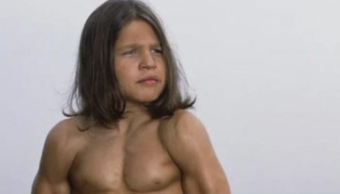 The 30-year-old boy has the most muscle. His unusual appearance astonished everyone.