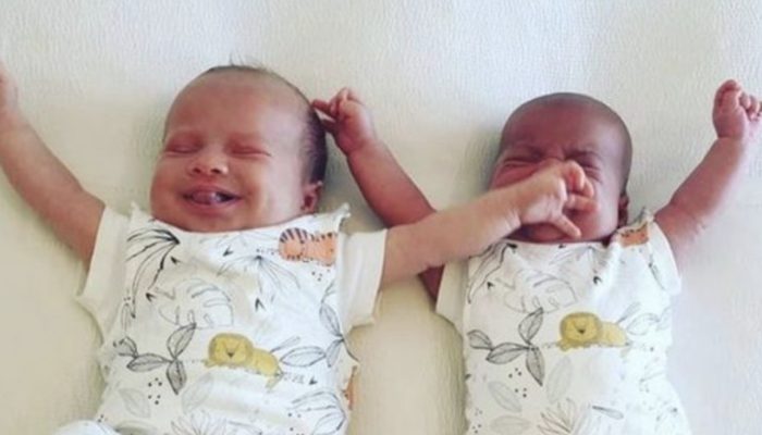 The chance of such twins being born is one in a million, but it occurred to this family.
