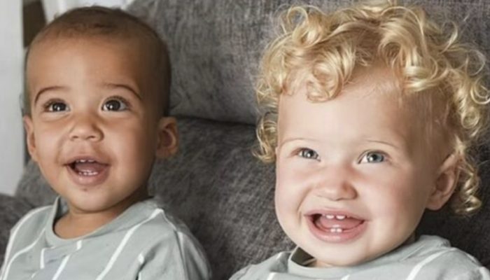 The chance of such twins being born is one in a million, but it occurred to this family.