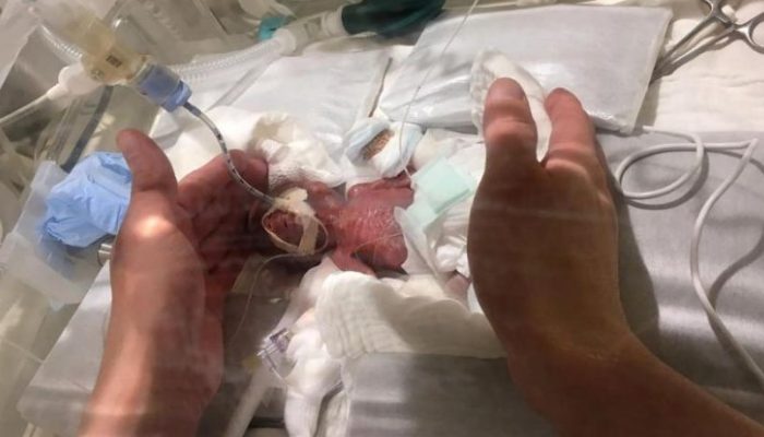 It defies logic that a baby weighing just 267 grams could survive