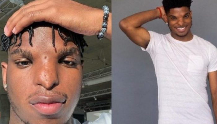 This kid was teased for the shape of his nose, yet he eventually became a successful model nevertheless