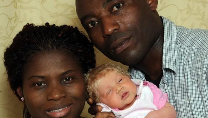 Now that we know the kid was born to a multiracial couple, we must examine his physical features