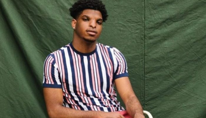 This kid was teased for the shape of his nose, yet he eventually became a successful model nevertheless