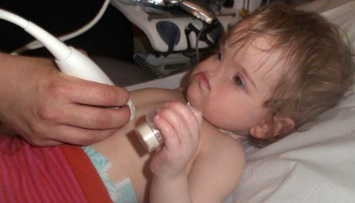 Tell us about the child's life now that she is eight years old and has lived without a nose from birth