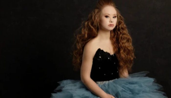 This young woman was born with Down syndrome and has struggled her whole life, yet she has accomplished all she has set out to achieve