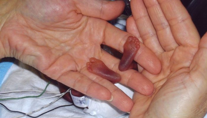 It defies logic that a baby weighing just 267 grams could survive