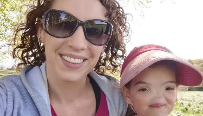 Tell us about the child's life now that she is eight years old and has lived without a nose from birth