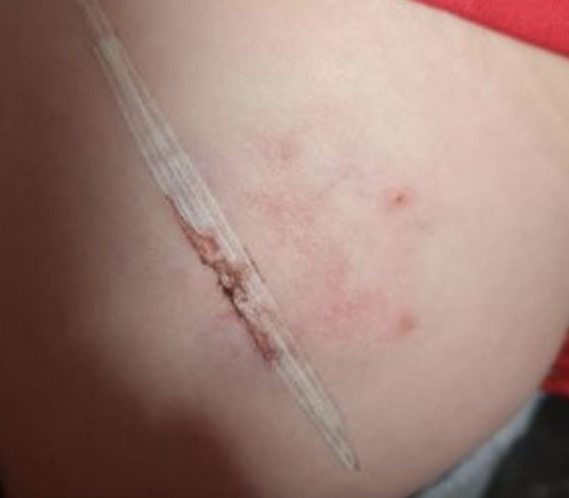 Lors d'un horrible incident, une mère "piétine" un chien après l'avoir vu mutiler deux fils "comme un morceau de viande"