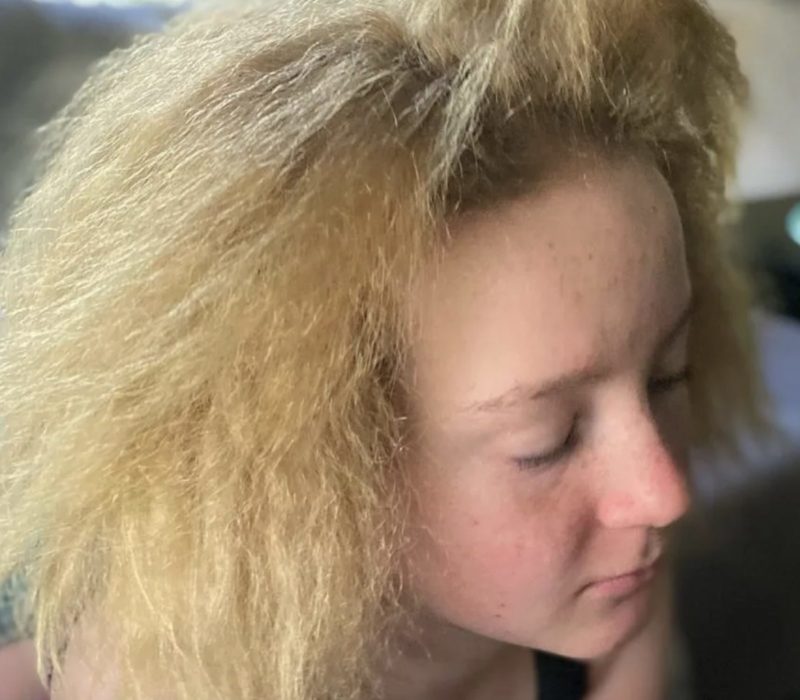 Une jeune fille accepte son syndrome des cheveux incoiffables et apprend à les porter avec style, mais les doigts des étrangers courent toujours à travers ses cheveux