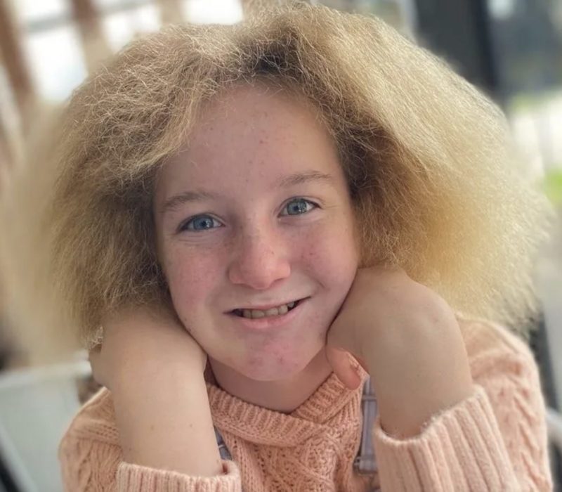 Une jeune fille accepte son syndrome des cheveux incoiffables et apprend à les porter avec style, mais les doigts des étrangers courent toujours à travers ses cheveux