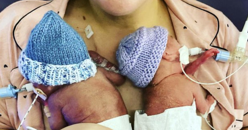 Les jumeaux les plus prématurés du Royaume-Uni «se portent bien» bien qu'ils aient eu peu de chances de vivre