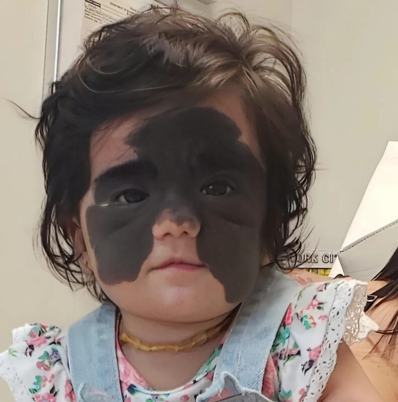 Egy lány, akit egy nagy sötét anyajegy miatt „szörnyszülöttnek” neveztek, miután átesett egy műtéten, gyönyörű és magabiztos nővé vált, akinek az arca már teljesen átváltozott.