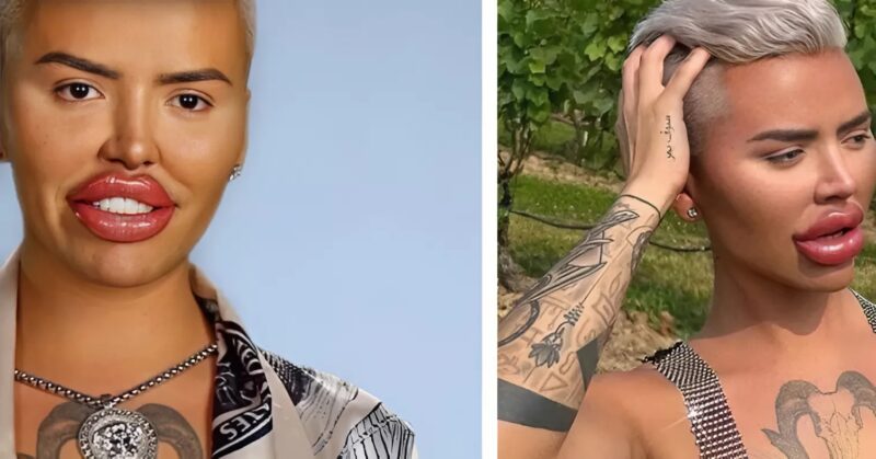 A szülők sokkolva: Egy fiatal férfi 20 műtéten esett át, hogy elérje álmának külsejét. Radikális átalakulása mindenkit megdöbbentett, kérdéseket vetve fel a szépség határait illetően.
