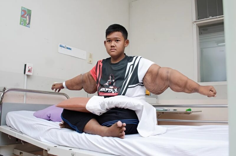 10 évesen már 190 kg-ot nyomott! Ő volt a legnehezebb gyermek, de megváltoztatta az életét, és lenyűgözte a világot hihetetlen átalakulásával! 🌟