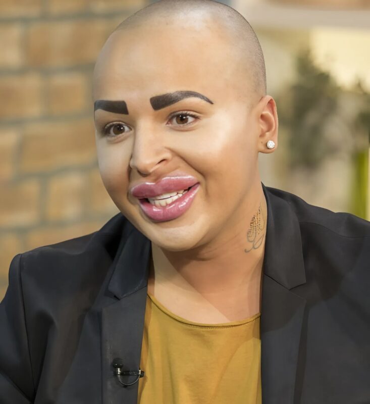 „Ő akarok lenni”: Egy férfi plasztikai műtétekkel vált Kim Kardashian hasonmásává.