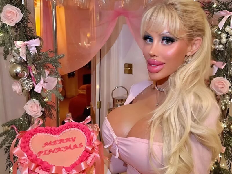 A lány számos műtéten esett át és 130 000 dollárt költött, hogy úgy nézzen ki, mint Barbie. Így nézett ki korábban, meglepődsz majd, mivé vált.