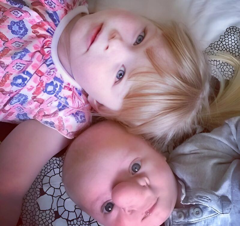 A kisfiú nagy orral született, csúfolták, Pinokkiónak hívták, de ő és az anyukája nem adták fel. Nézd meg, hogy néz ki ma.
