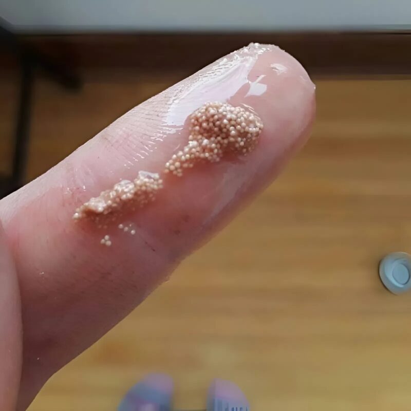 Találtam ezeket a kis nyálkás golyókat egy tojásban, és azt hittem, rovartojások, de aztán megtudtam a szörnyű igazságot, és megdöbbentem.