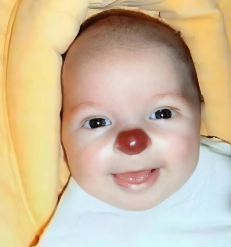„Hű, de bohócarora van.” Hogyan él és hogyan mutatkozik meg ma egy lány, akit születése óta „bohócnak” bélyegeznek?