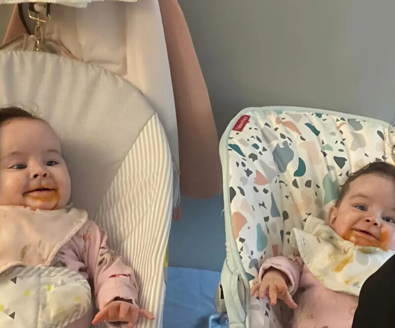 Az összenőtt ikreket egy bonyolult, több órán át tartó műtét után választották szét. ։ Nézd meg, hogyan néznek ki három évvel később.
