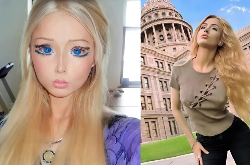 Felismerhetetlenségig átalakult, és világszerte híressé vált pusztán azért, mert úgy nézett ki, mint egy Barbie baba - íme, hogyan nézett ki korábban.