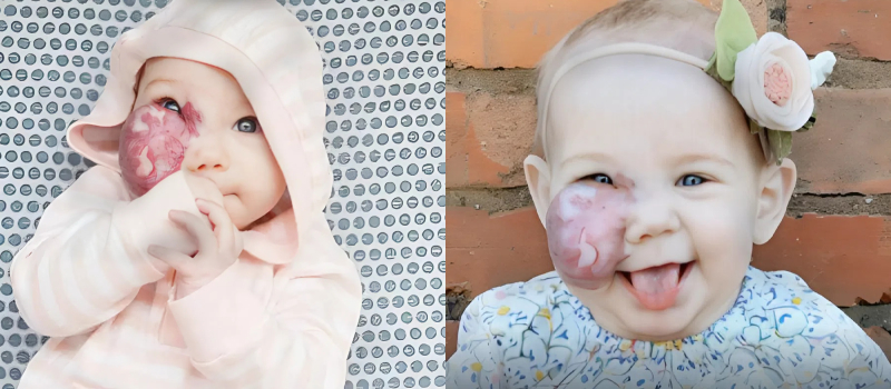Egy olyan növedékkel született, ami elvette volna a mosolyát, de az életnek más tervei voltak – egy csoda, amit még az orvosok sem tudtak megmagyarázni.