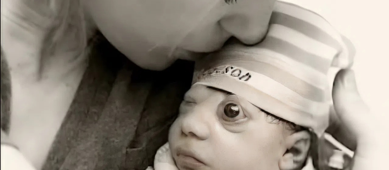 Egy anencephaliás gyermek, akinek az élete sokakra hatással volt, íme, mi változtatta meg az életét.