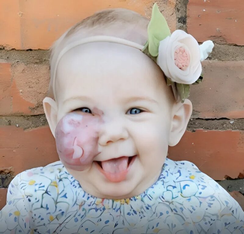 Egy olyan növedékkel született, ami elvette volna a mosolyát, de az életnek más tervei voltak – egy csoda, amit még az orvosok sem tudtak megmagyarázni.