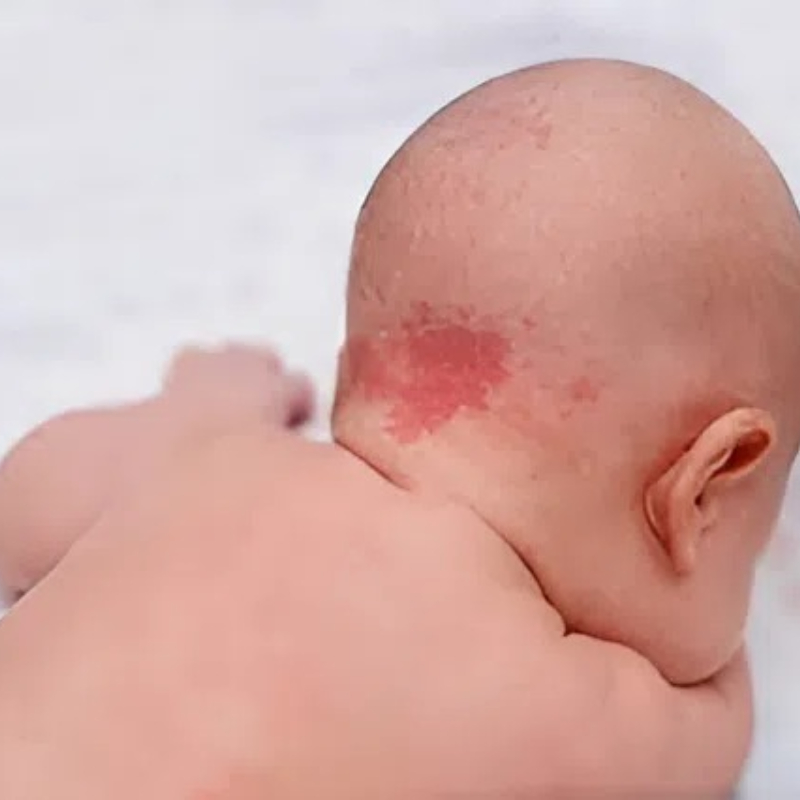 A fiam egy anyajeggyel született az arcán. Az emberek nyíltan csúnyának nevezték. Három évvel később ugyanezek a hangok elhallgattak, megdöbbenve azon, hogy az idő, a szeretet és a fejlődés hogyan írta át a történetét.