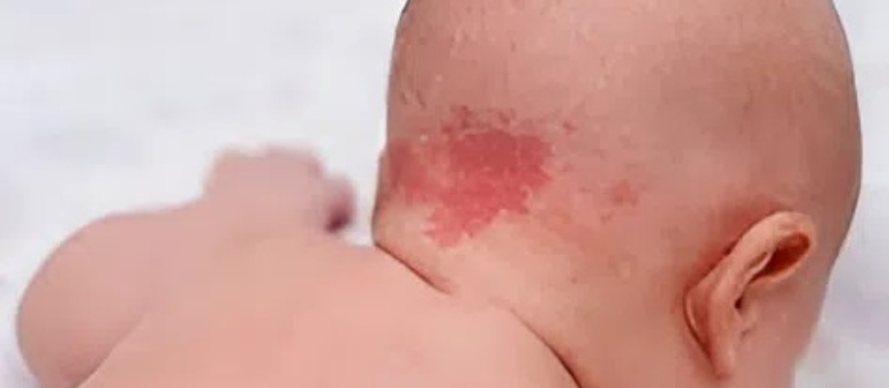 A fiam egy anyajeggyel született az arcán. Az emberek nyíltan csúnyának nevezték. Három évvel később ugyanezek a hangok elhallgattak, megdöbbenve azon, hogy az idő, a szeretet és a fejlődés hogyan írta át a történetét.