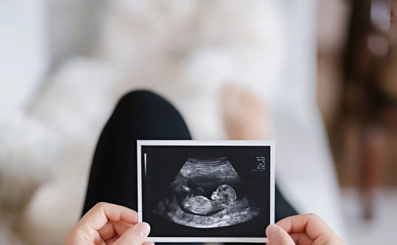 Az ultrahangvizsgálat során az orvos hirtelen megállt, tanulmányozta az arckifejezésemet, és meglepetten közölte, hogy az eredmények teljesen váratlanok, egy pillanat alatt megváltoztatva az egész látogatás értelmét.
