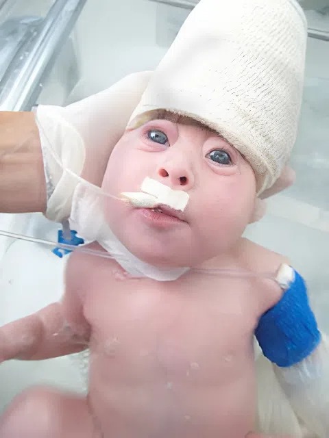 Egy koponya nélkül született baba próbál túlélni, nézd meg a videót és a fotókat, hogy lásd, hogyan néz ki most.