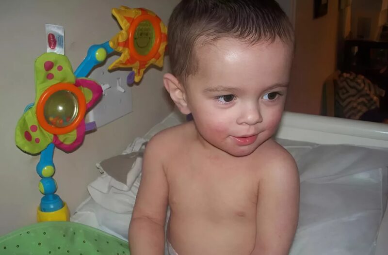 Az anya azt gondolta, hogy az ő „olvadó bőrével” a gyermek jobb lesz halottnak lenni, de a házi készítésű balzsama meggyógyította.