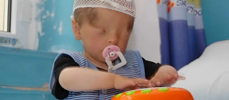 A kisfiú, aki szem nélkül született, de imád zseblámpákkal játszani, mert... magyarázza az orvos.
