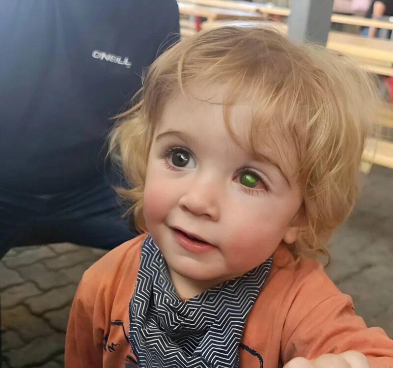 „Soha ne csókold meg más babáját” – figyelmezteti sürgetően az embereket egy anya, miközben az orvosok küzdenek gyermeke szemének megmentéséért. Íme, mi történt.