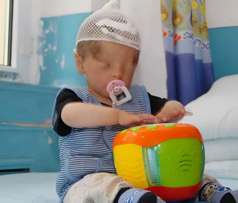 A kisfiú, aki szem nélkül született, de imád zseblámpákkal játszani, mert... magyarázza az orvos.